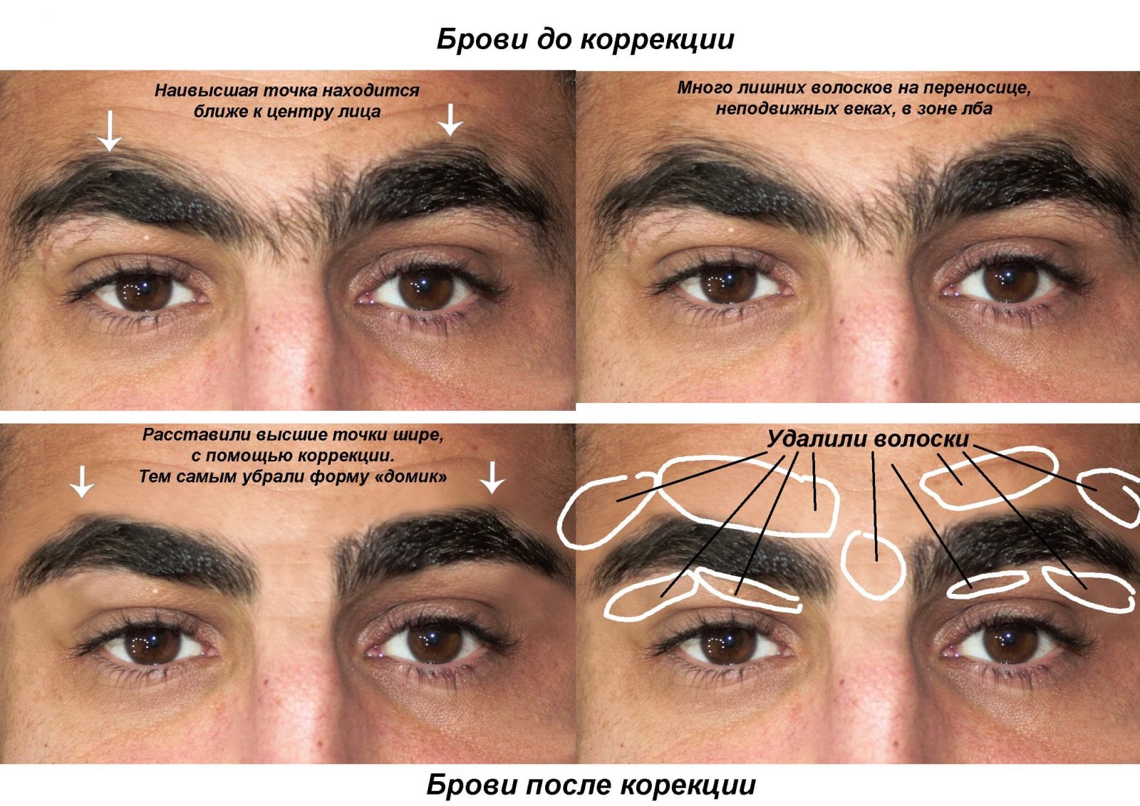 Коррекция бровей у мужчин до и после фото